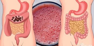 როგორ გამოვიყენოთ ჭარხალი ღვიძლისა და მსხვილი ნაწლავის გასაწმენდად? საინტერესოა…