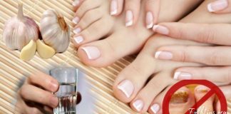 ფრჩხილის სოკოს მკურნალობა ხალხური მეთოდებით. დაუბრუნეთ თქვენს ფეხებს სილამაზე და ჯანმრთელობა