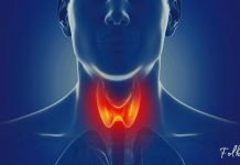 შეამოწმეთ საკუთარი თავი! ფარისებრი ჯირკვლის პრობლემის 12 სიმპტომი