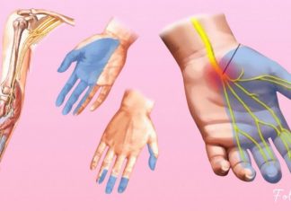 როგორ მოვიქცეთ კიდურების დაბუჟების დროს? ეფექტური და მრავალჯერ ნაცადი მეთოდები