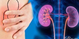 იდეალური საშუალება თირკმლებში გაჩენილი კენჭების წინააღმდეგ. ეფექტურია