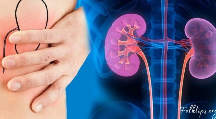 იდეალური საშუალება თირკმლებში გაჩენილი კენჭების წინააღმდეგ. ეფექტურია