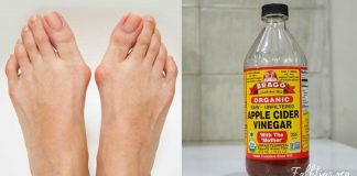 როგორ გავთავისუფლდეთ ნიკრისის ქარისგან ამ ინგრედიენტების გამოყენებით?