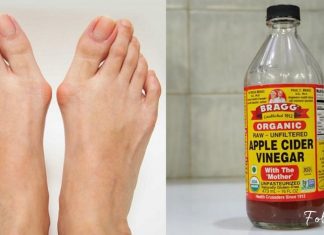 როგორ გავთავისუფლდეთ ნიკრისის ქარისგან ამ ინგრედიენტების გამოყენებით?