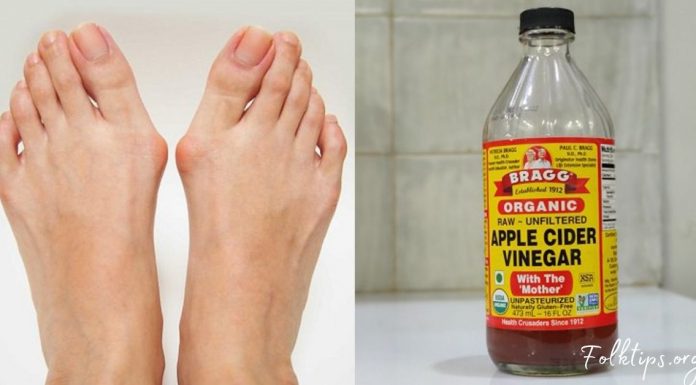 როგორ გავთავისუფლდეთ ნიკრისის ქარისგან ამ ინგრედიენტების გამოყენებით?