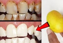 როგორ უნდა გაითეთროთ კბილები 2 წუთში? ყველაზე სწრაფი და ეფექტური მეთოდია