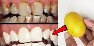 როგორ უნდა გაითეთროთ კბილები 2 წუთში? ყველაზე სწრაფი და ეფექტური მეთოდია