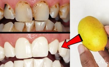 როგორ უნდა გაითეთროთ კბილები 2 წუთში? ყველაზე სწრაფი და ეფექტური მეთოდია