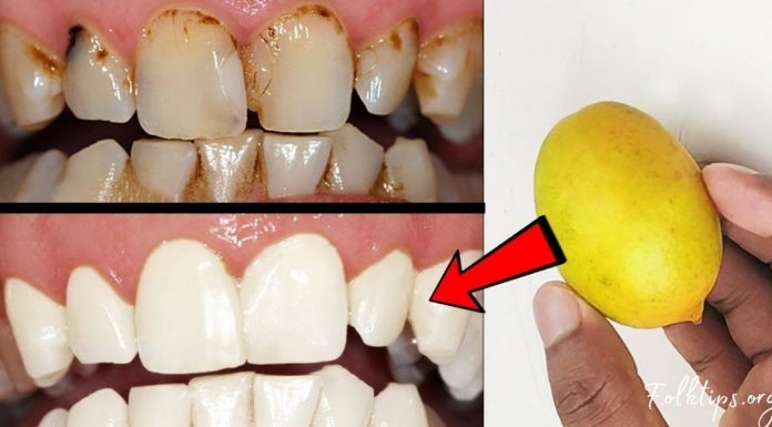 როგორ უნდა გაითეთროთ კბილები 2 წუთში? ყველაზე სწრაფი და ეფექტური მეთოდია