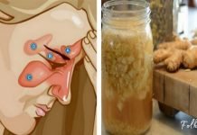 როგორ ვებრძოლოთ სინუსიტს ორი ინგრედიენტის დახმარებით? ყველაზე ეფექტურია