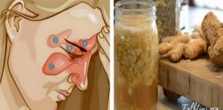 როგორ ვებრძოლოთ სინუსიტს ორი ინგრედიენტის დახმარებით? ყველაზე ეფექტურია