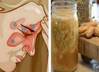 როგორ ვებრძოლოთ სინუსიტს ორი ინგრედიენტის დახმარებით? ყველაზე ეფექტურია