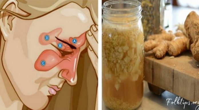 როგორ ვებრძოლოთ სინუსიტს ორი ინგრედიენტის დახმარებით? ყველაზე ეფექტურია