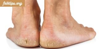 მეთოდი,რომლის შემდეგიც გაგაოცებთ.დაბზარული ქუსლების მკურნალობა და ფეხებზე კანის მოვლის მარტივი წესები.