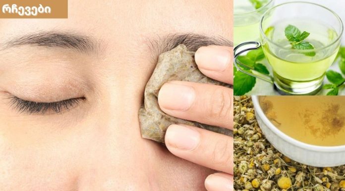 საოცარი შედეგი მივიღე,აღარ მაწუხებს თვალების ტკივილი.ეს მეთოდი ნებისმიერი ასაკისთვისაა.