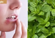 როგორ მოვიშოროთ ტუჩის ჰერპესი ერთ დღეში.