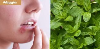 როგორ მოვიშოროთ ტუჩის ჰერპესი ერთ დღეში.