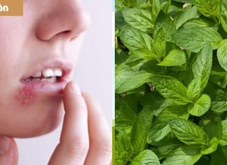 როგორ მოვიშოროთ ტუჩის ჰერპესი ერთ დღეში.