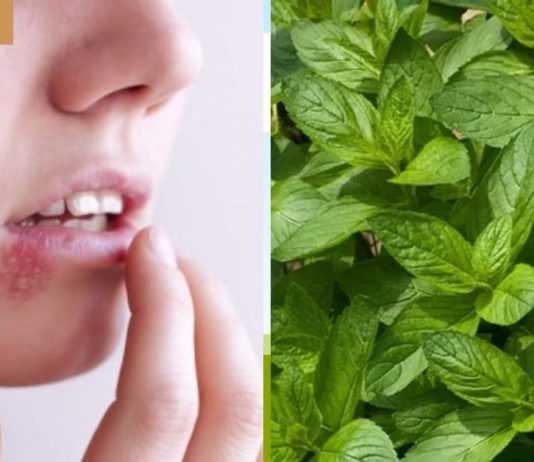 როგორ მოვიშოროთ ტუჩის ჰერპესი ერთ დღეში.