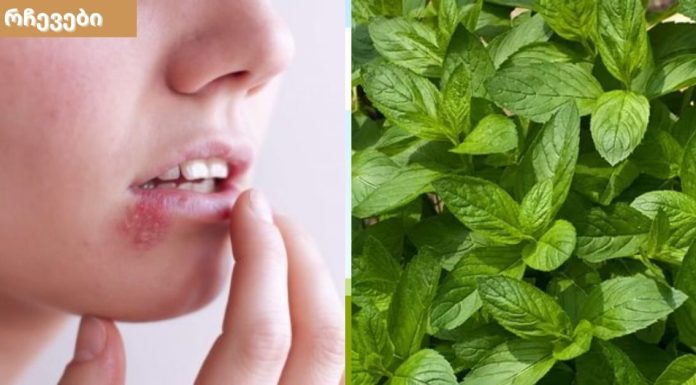 როგორ მოვიშოროთ ტუჩის ჰერპესი ერთ დღეში.