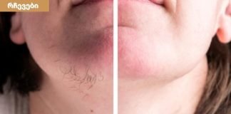 სახეზე არასასურველი თმის მოცილების ბუნებრივი გზები,რომელიც მოგცემთ საუკეთესო შედეგს.