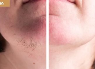 სახეზე არასასურველი თმის მოცილების ბუნებრივი გზები,რომელიც მოგცემთ საუკეთესო შედეგს.