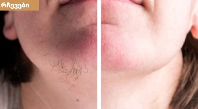 სახეზე არასასურველი თმის მოცილების ბუნებრივი გზები,რომელიც მოგცემთ საუკეთესო შედეგს.