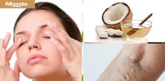 ქოქოსის ზეთი თქვენი კანის სილამაზისთვის,გამოიყენება ვარიკოზული ვენების გაგანიერების დროსაც.