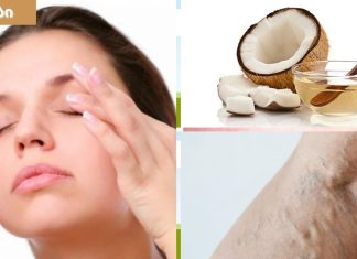 ქოქოსის ზეთი თქვენი კანის სილამაზისთვის,გამოიყენება ვარიკოზული ვენების გაგანიერების დროსაც.