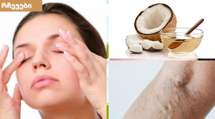 ქოქოსის ზეთი  თქვენი კანის სილამაზისთვის,გამოიყენება ვარიკოზული ვენების გაგანიერების დროსაც.