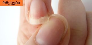 აი,რა უნდა იცოდეთ მტვრევადი ფრჩხილების შესახებ.