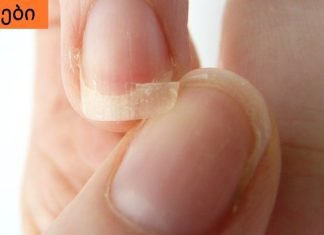 აი,რა უნდა იცოდეთ მტვრევადი ფრჩხილების შესახებ.