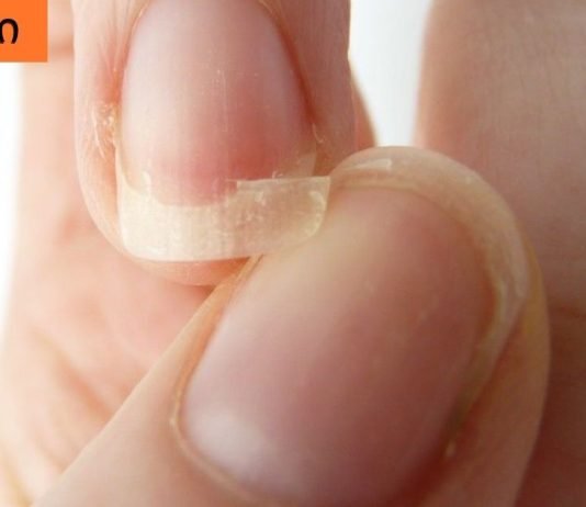 აი,რა უნდა იცოდეთ მტვრევადი ფრჩხილების შესახებ.