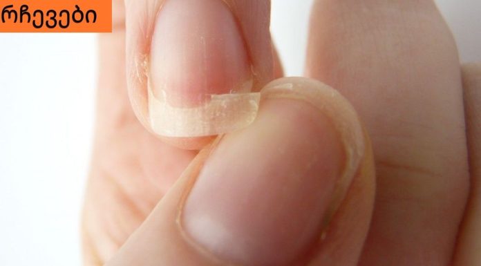 აი,რა უნდა იცოდეთ მტვრევადი ფრჩხილების შესახებ.