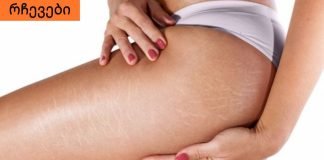 როგორ მოვიშოროთ სტრიები სხეულზე.