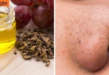 როგორ მოვიშოროთ შავი წერტილები სამუდამოდ,ყველაზე მარტივი რეცეპტი.