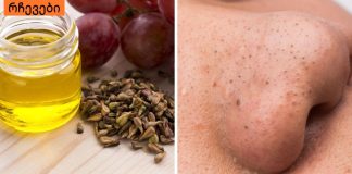 როგორ მოვიშოროთ შავი წერტილები სამუდამოდ,ყველაზე მარტივი რეცეპტი.