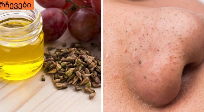 როგორ მოვიშოროთ შავი წერტილები სამუდამოდ,ყველაზე მარტივი რეცეპტი.