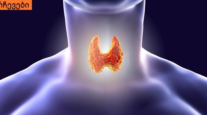 5 ყველაზე სასარგებლო პროდუქტი ფარისებრი ჯირკვლისთვის. საჭირო ინფორმაციაა