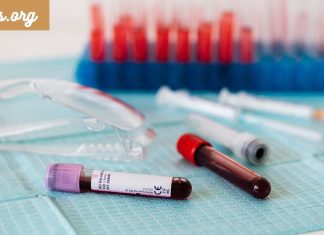 ნახეთ , როგორ შეამოწმოთ თვენი იმუნიტეტი. ორგანიზმი მზად არის ,თუ არა შემოდგომა-ზამთრის პერიოდისთვის.