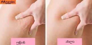 როგორ გავთავისუფლდეთ ცელულიტისგან? 100%-იანი შედეგი მხოლოდ 1 კვირაში