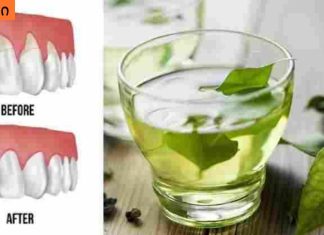 ღრძილის რეტრაქციას ეს 4 ინგრედიენტი შველის! რთული პრობლემის მარტივი გადაწყვეტა!