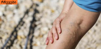 ვინ შეიძლება იყოს თრომბოზის რისკის ქვეშ და რამდენად საშიშია ის?