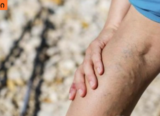 ვინ შეიძლება იყოს თრომბოზის რისკის ქვეშ და რამდენად საშიშია ის?