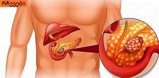 პანკრეასის ანთების ადრეული ნიშნები. გულის რევა ,ღებინება,სხვა დაავადებაშ არ შეგეშალოთ.