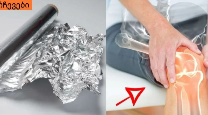 ამ ქალმა სახსრების ტკივილს ამ ჩვეულებრივი საგნით უშველა! ძალიან მარტივი და ეშმაკურია…