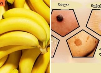 მოიცილეთ მეჭეჭები,მუქი ლაქები და ფორები მარტივი მეთოდებით.