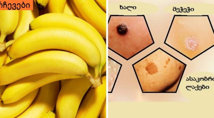 მოიცილეთ მეჭეჭები,მუქი ლაქები და ფორები მარტივი მეთოდებით.