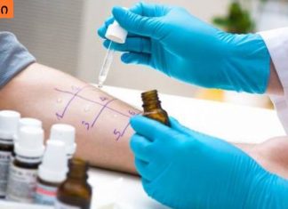 იხილეთ,რა ტესტები ტარდება ალერგიის არსებობის დასადგენად.