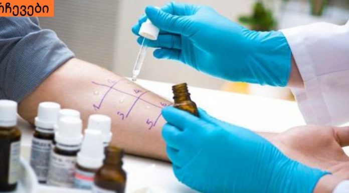 იხილეთ,რა ტესტები ტარდება ალერგიის არსებობის დასადგენად.